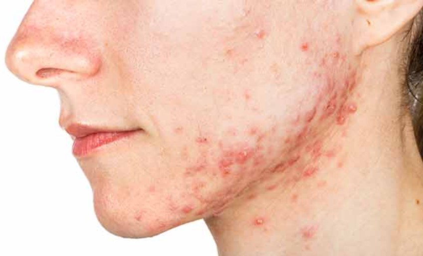 Dermatology Services | Arya Skin/ Hair and Surgery Clinic